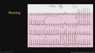 Technology SeriesMedicalStress Testing Pearls [upl. by Lleryd]