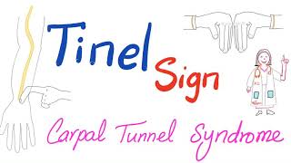 Carpal Tunnel Release  Open Procedure vs Endoscopic [upl. by Niu234]