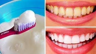 10 Natural Ways to Whiten Teeth at Home [upl. by Anjela]