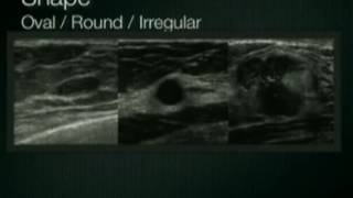 Pelvic Floor Assessment by Ultrasound [upl. by Hardan]