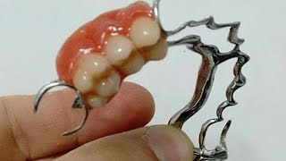 Reformando uma prótese dentária  armação de ppr [upl. by Argella]