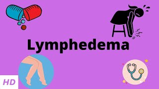 Exercise to manage Lymphedema post breast cancer treatment [upl. by Krystal414]