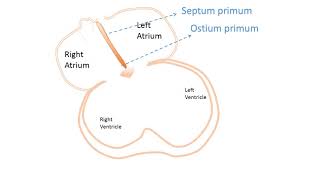 interatrial Septum development [upl. by Aihsenot709]