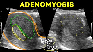 Endobronchial Ultrasound EBUS Technique amp Tips [upl. by Nelag]