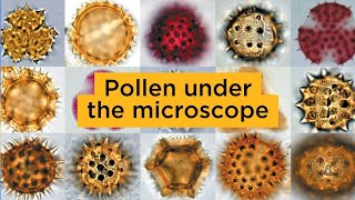 Pollen under the microscope [upl. by Htilil]