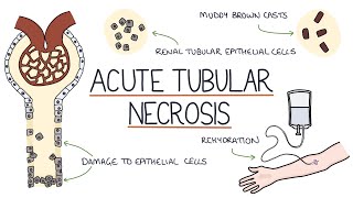 Understanding Acute Tubular Necrosis [upl. by Netnert]