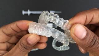 How to use Tooth Whitening Trays [upl. by Nylevol]