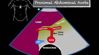 How to Perform Transabdominal Ultrasound [upl. by Aicnerolf232]