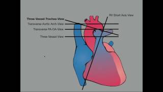 Topics in Fetal Medicine MR Fetal Imaging [upl. by Roath]