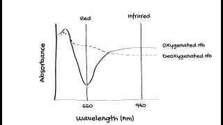 How does Pulse Oximetry work [upl. by Retsae]