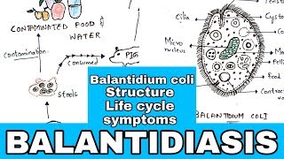 Balantidiasis  Balantidium coli Structure Life cycle Symptoms Medication  Bio science [upl. by Barri]