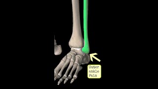 Outer  Lateral Ankle Pain Strength and Exercise [upl. by Raddy997]