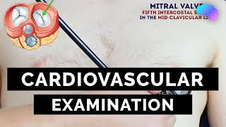 Cardiovascular Examination  OSCE Guide  UKMLA  CPSA  PLAB 2 [upl. by Nonad]