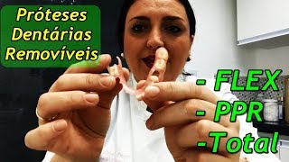 3 Principais Tipos de Prótese Dentária Removível [upl. by Kerri]