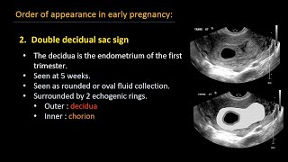 Abdominal Ultrasound Guidelines for best reporting [upl. by Ellertal]