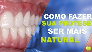 Como Fazer a Prótese com Implantes parecer Natural [upl. by Eidob]