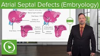 Cardiac Development by L McCabe  OPENPediatrics [upl. by Deidre591]