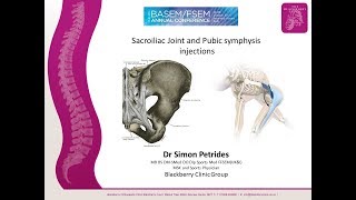 Sacroiliac Joint Injections and prolotherapy [upl. by Adnovad]