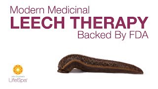 Modern Medicinal Leech Therapy Backed by FDA  John Douillards LifeSpa [upl. by Elissa]