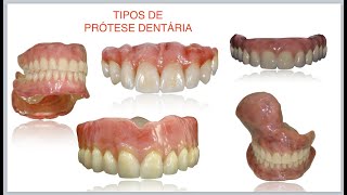 Tipos de prótese dentária fixas e removíveis [upl. by Yggep814]