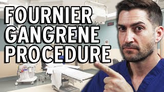 Fournier Gangrene Procedure  Brace Yourselves For This Story [upl. by Ermeena]