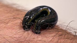 How Leeches are used in Modern Surgery  Earth Science [upl. by Aitas]