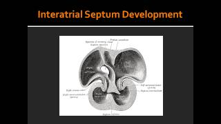 Interatrial Septum Development [upl. by Alaik499]