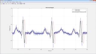 Signal Processing with MATLAB [upl. by Monson376]