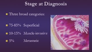 Bladder Cancer [upl. by Eelhsa]