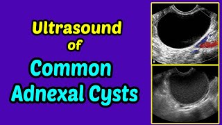 How I do it Ultrasound of the Abdomen [upl. by Mulac]