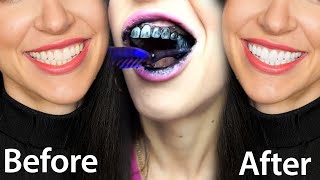 Fastest Way To Whiten Teeth At Home What REALLY Works [upl. by Aiek637]